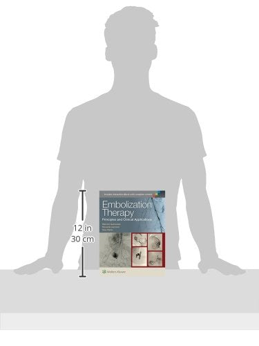 Embolization Therapy: Principles and Clinical Applications