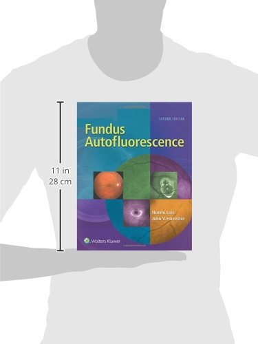 Fundus Autofluorescence