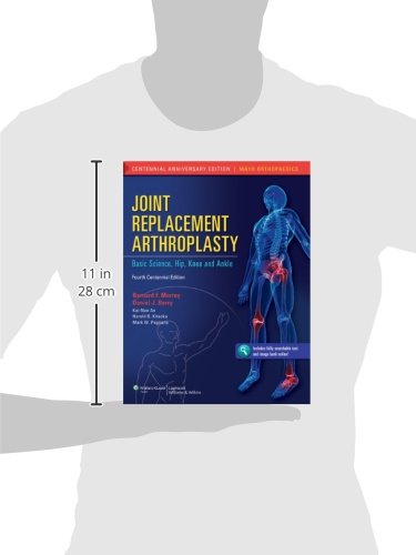 Joint Replacement Arthroplasty: Basic Science, Hip, Knee, and Ankle (Volume 2)