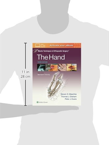 Master Techniques in Orthopaedic Surgery: The Hand