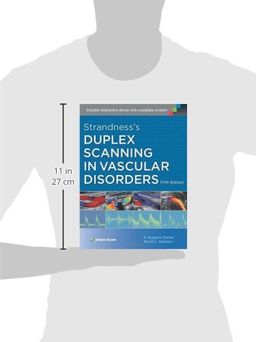 Strandness's Duplex Scanning in Vascular Disorders