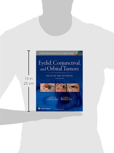 Eyelid, Conjunctival, and Orbital Tumors: An Atlas and Textbook