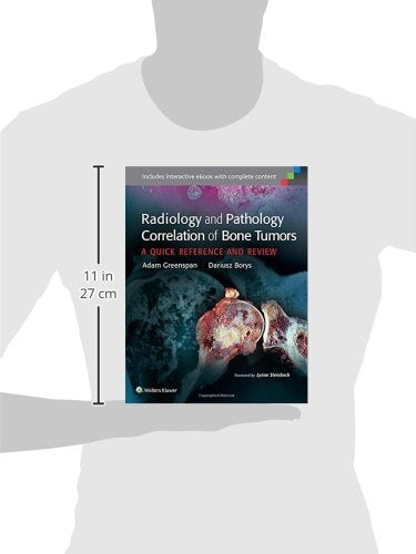 Radiology and Pathology Correlation of Bone Tumors: A Quick Reference and Review