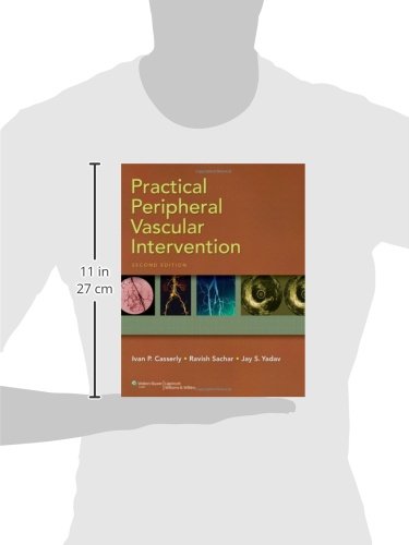 Practical Peripheral Vascular Intervention