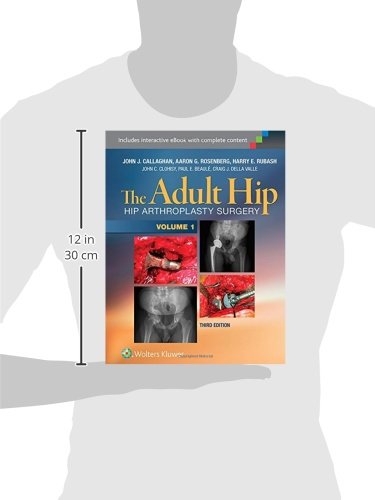 The Adult Hip (Two Volume Set): Hip Arthroplasty Surgery