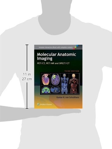 Molecular Anatomic Imaging: PET/CT, PET/MR and SPECT CT