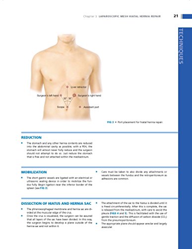 Operative Techniques in Foregut Surgery