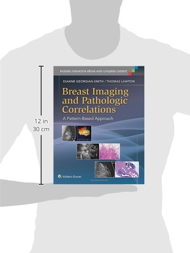 Breast Imaging and Pathologic Correlations: A Pattern-Based Approach
