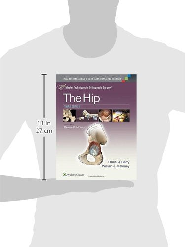 Master Techniques in Orthopaedic Surgery: The Hip