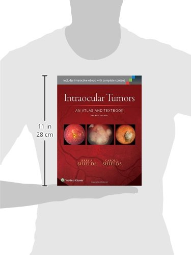 Intraocular Tumors: An Atlas and Textbook (Volume 1)