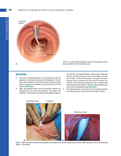 Operative Techniques in Thoracic and Esophageal Surgery