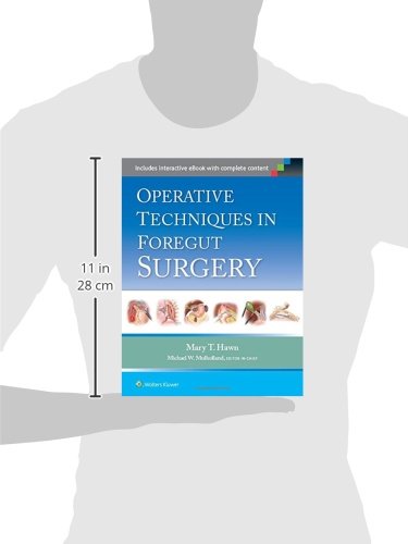 Operative Techniques in Foregut Surgery