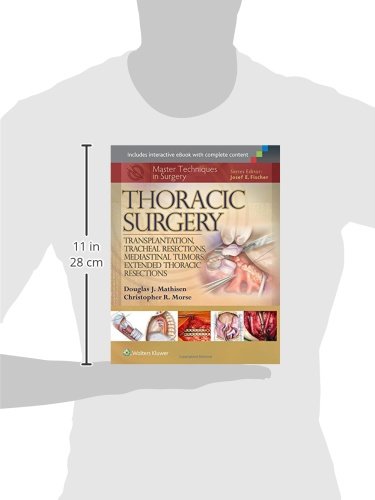 Master Techniques in Surgery: Thoracic Surgery: Transplantation, Tracheal Resections, Mediastinal Tumors, Extended Thoracic Resections