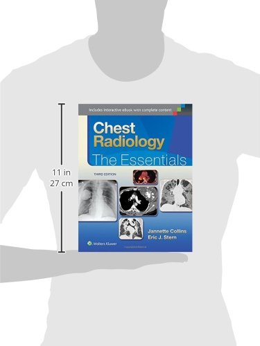 Chest Radiology: The Essentials (Essentials Series)