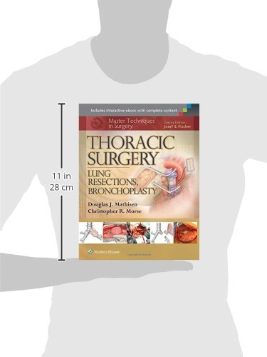 Master Techniques in Surgery: Thoracic Surgery: Lung Resections, Bronchoplasty