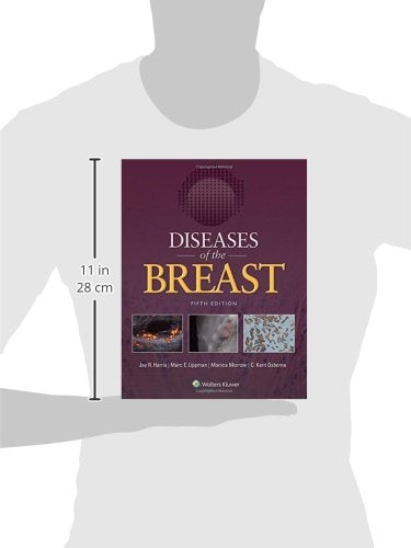 Diseases of the Breast 5e