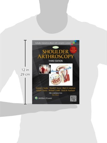 Shoulder Arthroscopy