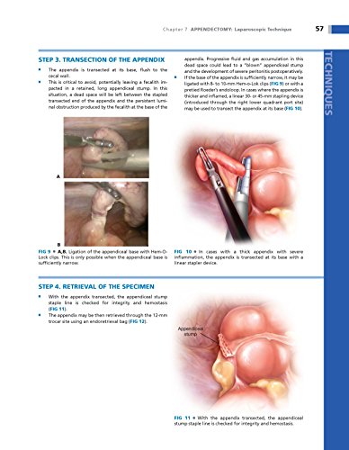Operative Techniques in Colon and Rectal Surgery