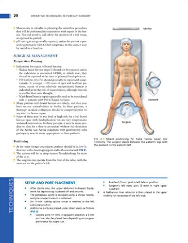 Operative Techniques in Foregut Surgery