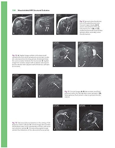 Musculoskeletal MRI Structured Evaluation: How to Practically Fill the Reporting Checklist