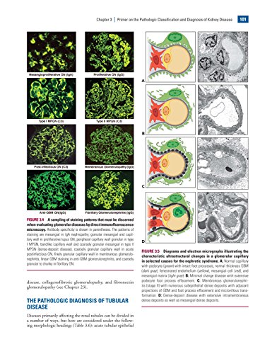 Heptinstall's Pathology of the Kidney