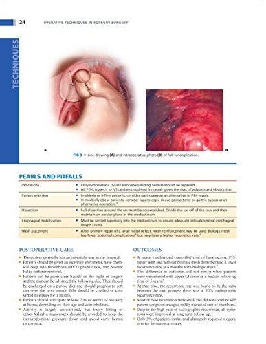 Operative Techniques in Foregut Surgery