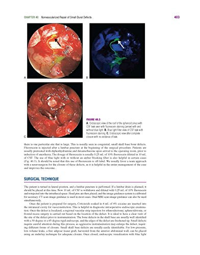 Master Techniques in Otolaryngology - Head and Neck Surgery: Skull Base Surgery