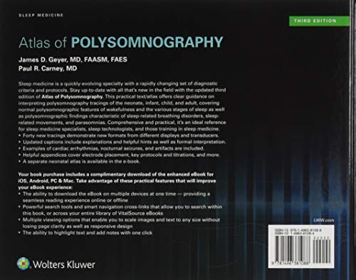 Atlas of Polysomnography