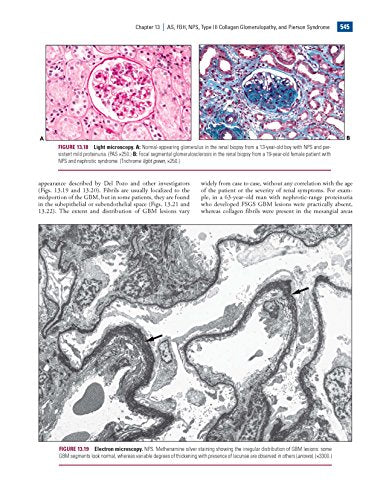 Heptinstall's Pathology of the Kidney