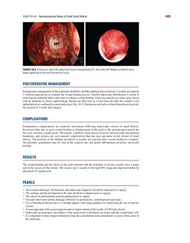 Master Techniques in Otolaryngology - Head and Neck Surgery: Skull Base Surgery