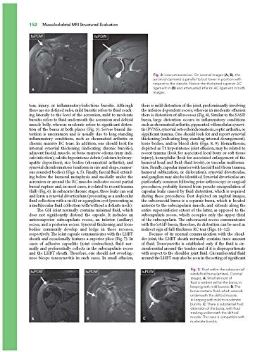 Musculoskeletal MRI Structured Evaluation: How to Practically Fill the Reporting Checklist