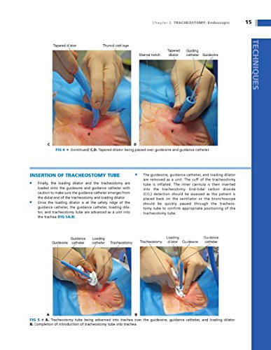 Operative Techniques in Thoracic and Esophageal Surgery
