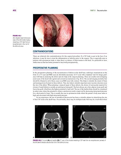 Master Techniques in Otolaryngology - Head and Neck Surgery: Skull Base Surgery