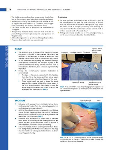 Operative Techniques in Thoracic and Esophageal Surgery