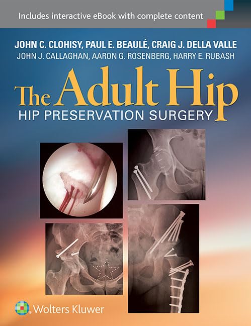 The Adult Hip: Hip Preservation Surgery