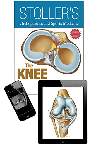 Stoller's Orthopaedics and Sports Medicine: The Knee: Includes Stoller Lecture Videos and Stoller Notes