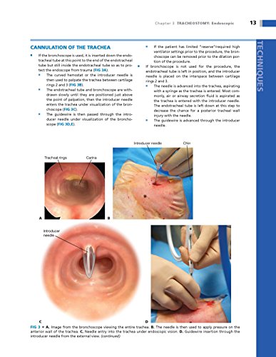 Operative Techniques in Thoracic and Esophageal Surgery