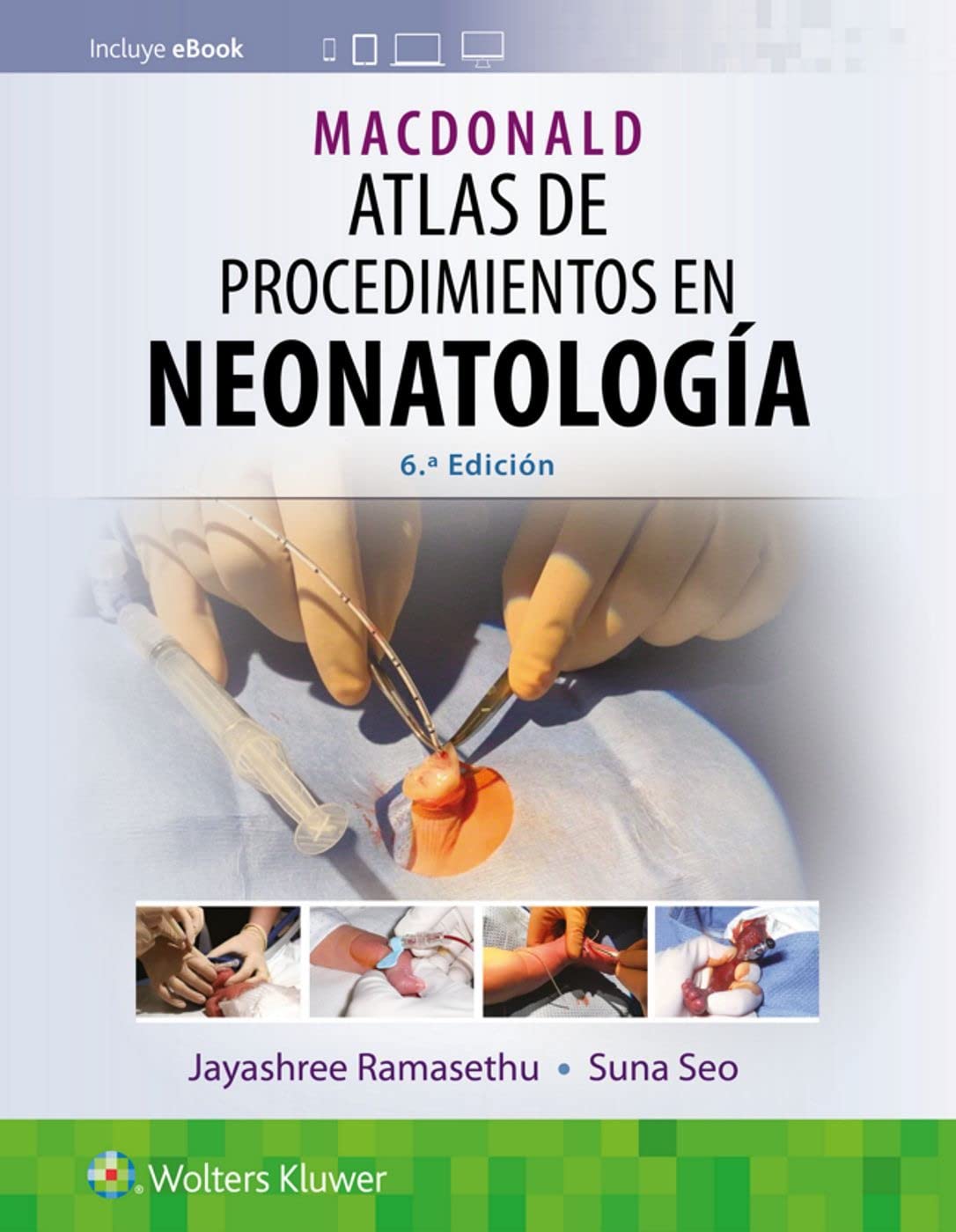 MacDonald. Atlas de procedimientos en neonatología (Spanish Edition)