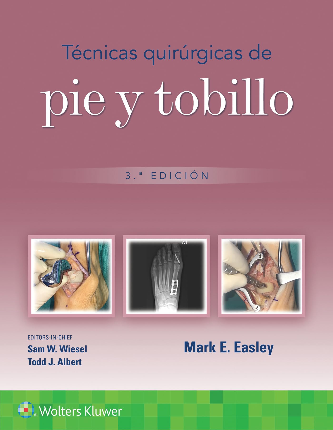 Técnicas quirúrgicas de pie y tobillo (Spanish Edition)