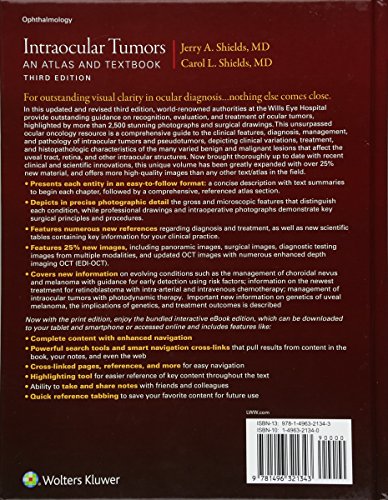 Intraocular Tumors: An Atlas and Textbook (Volume 1)