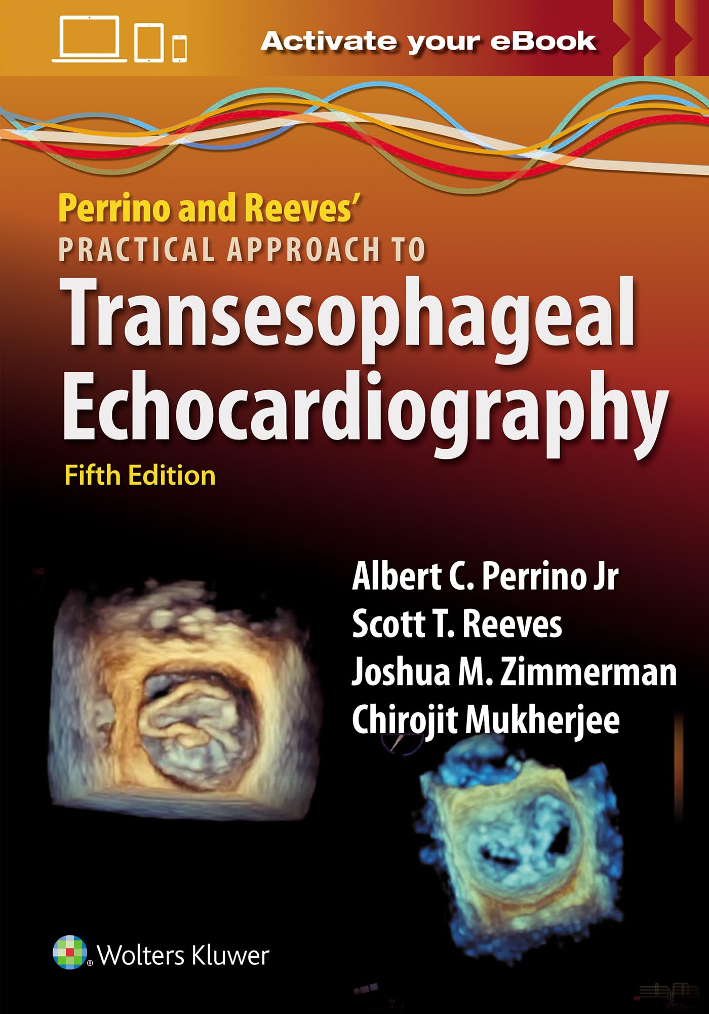 Perrino and Reeves' Practical Approach to Transesophageal Echocardiography: Print + ebook with Multimedia