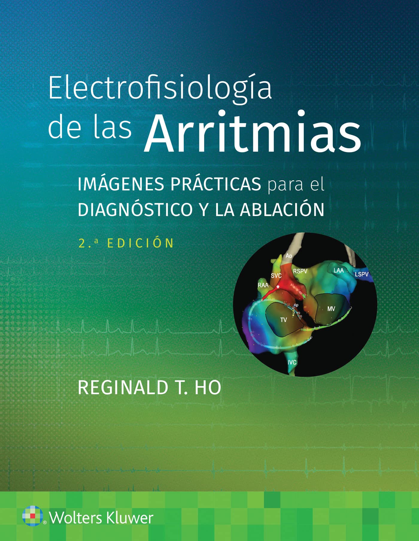 Electrofisiología de las arritmias: Imágenes prácticas para el diagnóstico y la ablación (Spanish Edition)