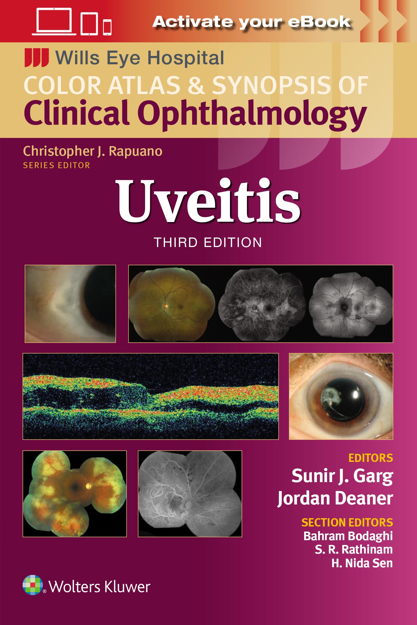 Uveitis (Wills Eye Institute Atlas Series)