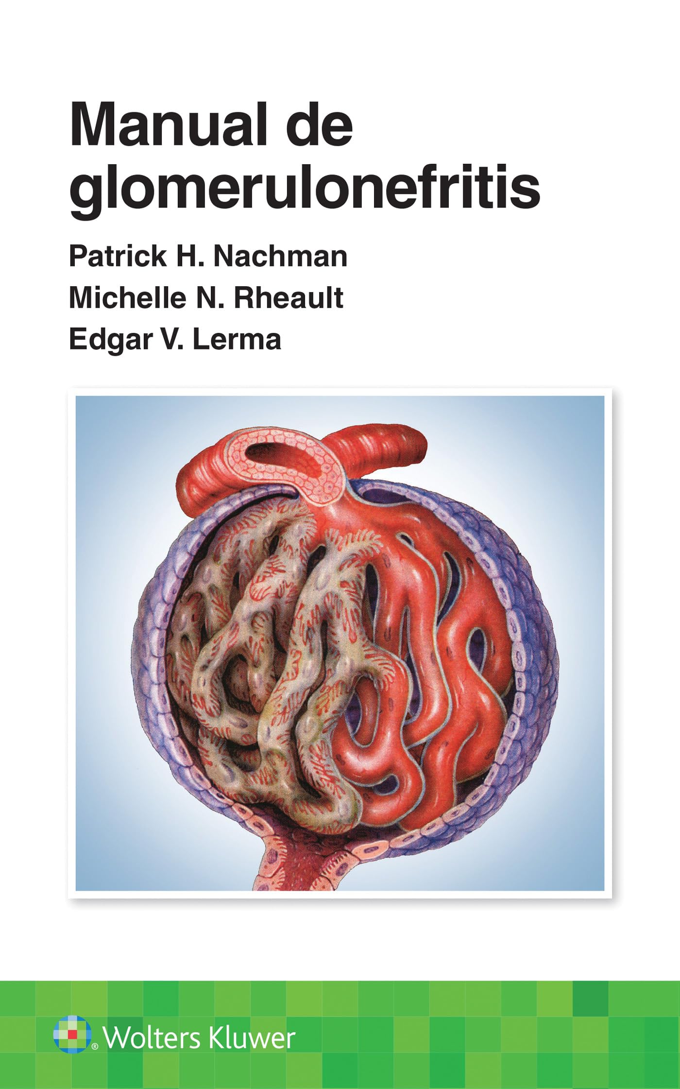 Manual de glomerulonefritis (Spanish Edition)