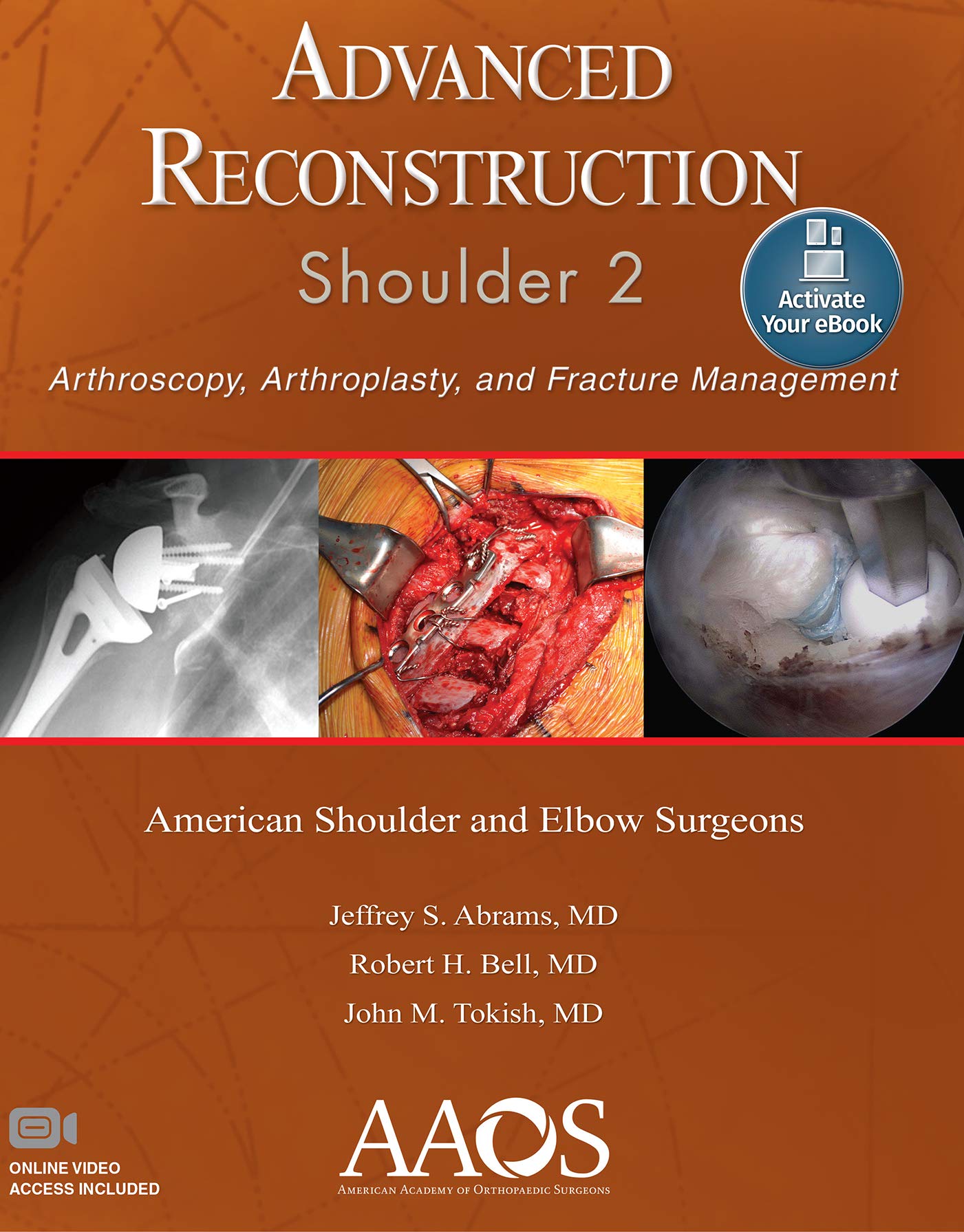 Advanced Reconstruction: Shoulder 2: Print + Ebook with Multimedia (AAOS - American Academy of Orthopaedic Surgeons)