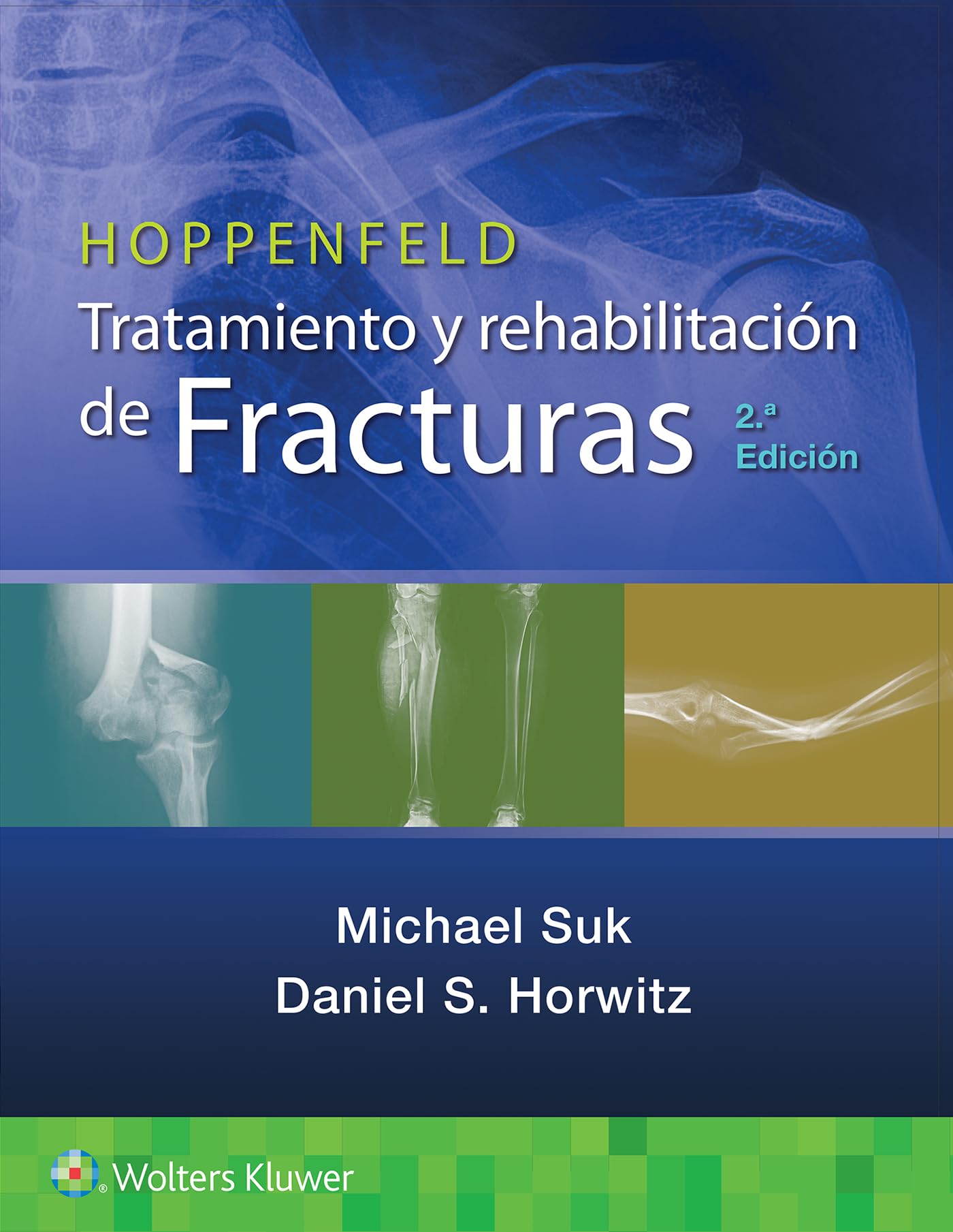 Hoppenfeld. Tratamiento y rehabilitación de fracturas (Spanish Edition)