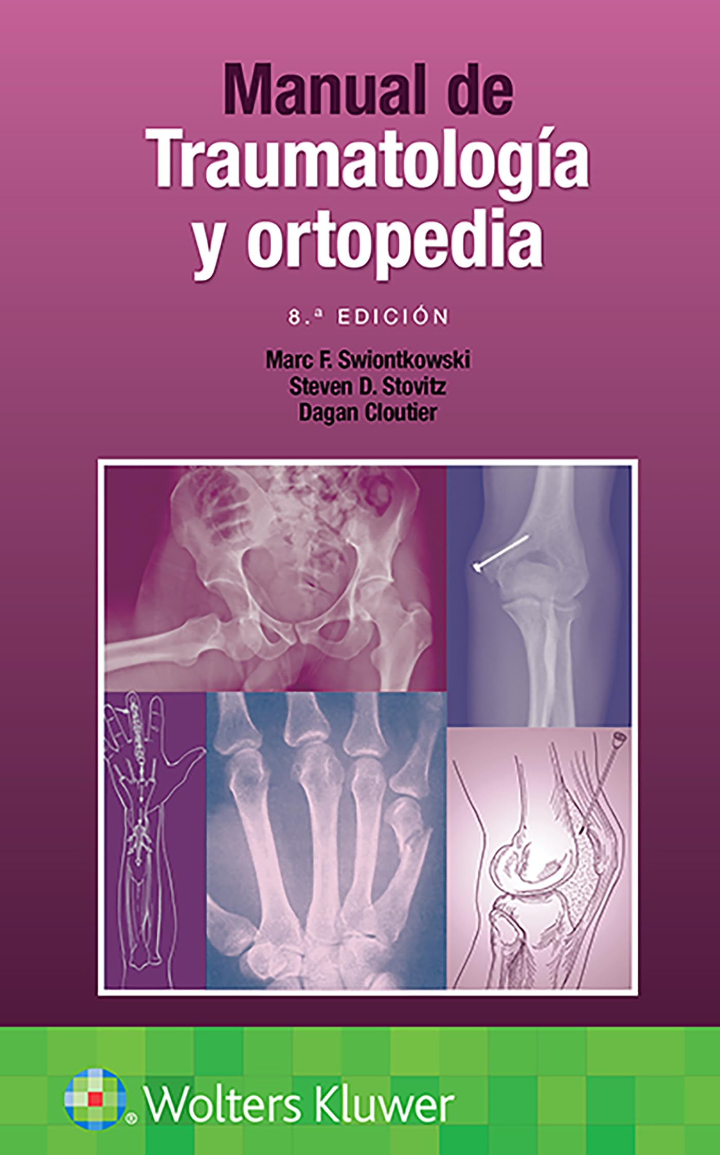 Manual de traumatología y ortopedia (Spanish Edition)