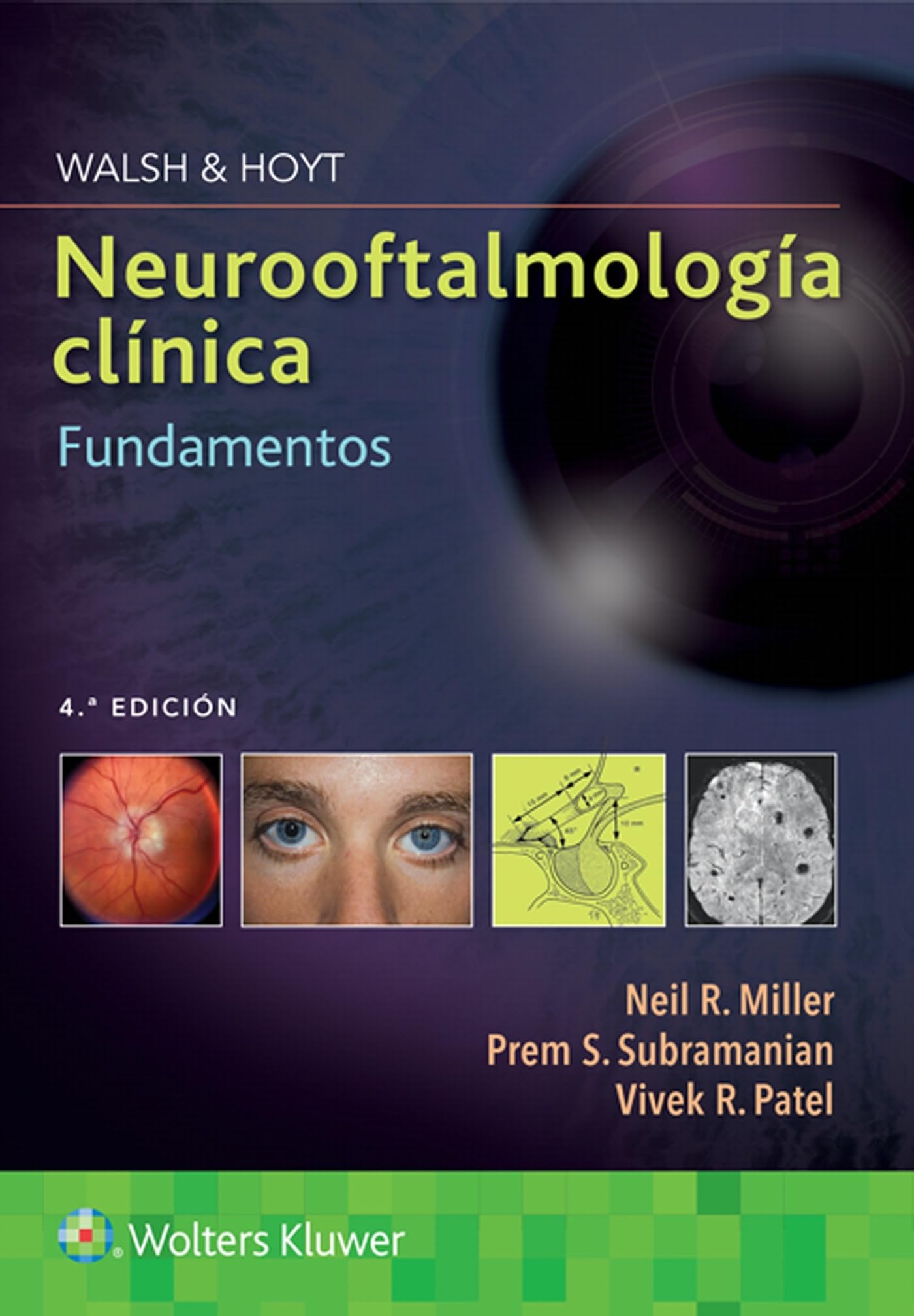 Walsh & Hoyt. Neurooftalmología clínica. Fundamentos (Spanish Edition)