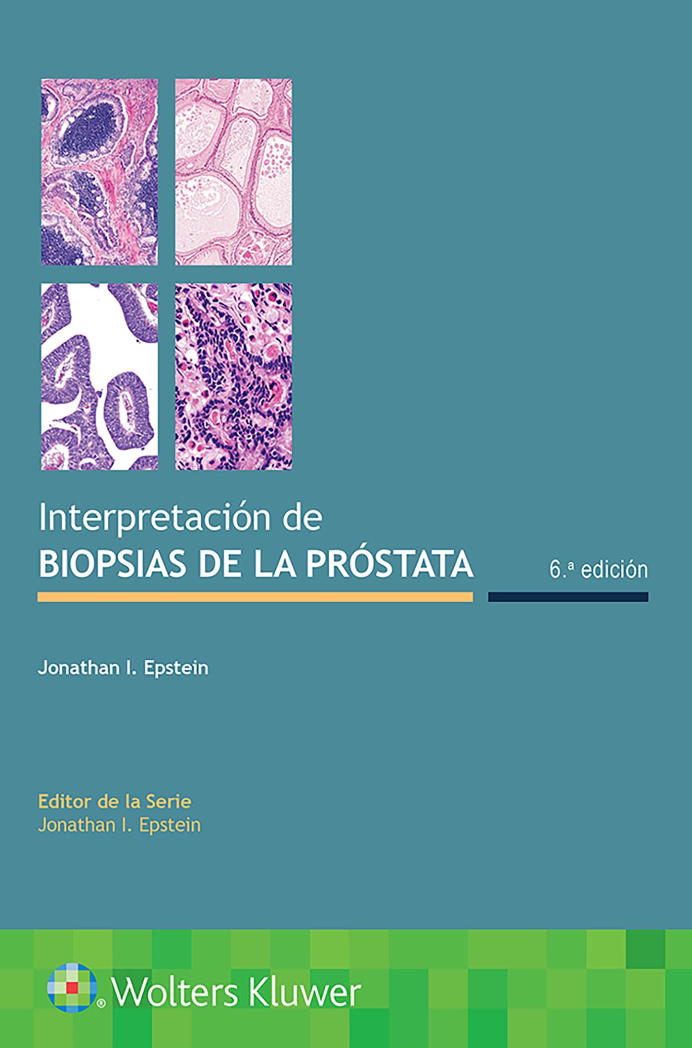 Interpretación de biopsias de la próstata (Spanish Edition)