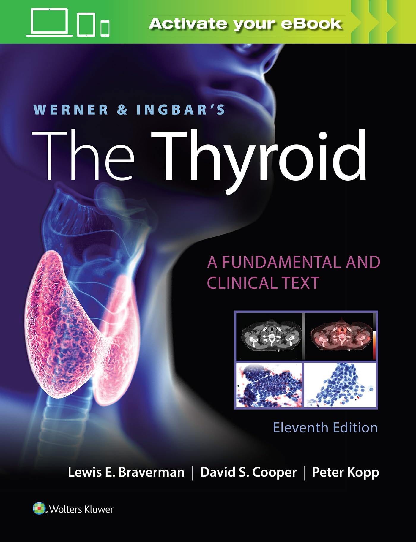 Werner & Ingbar's The Thyroid (Werner and Ingbars the Thyroid)